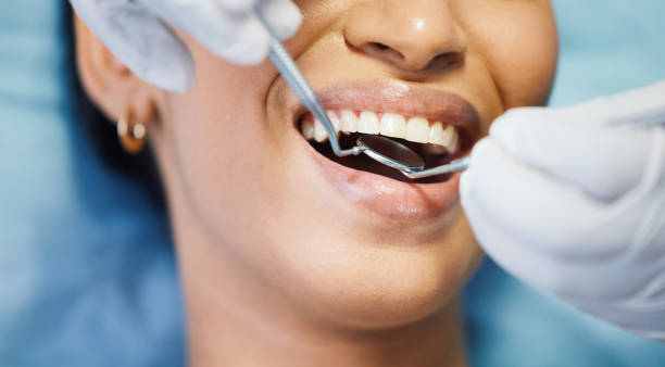 Best Emergency Dental Care for Trauma or Injury in Marshfield, MO